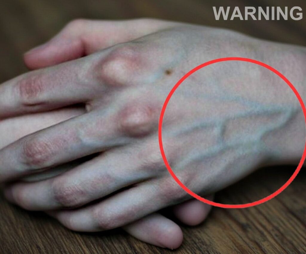 If your veins are visible in your hand, it is a signal of ca…