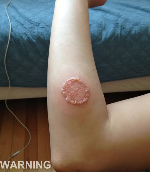 These are the consequences of sleeping with the…